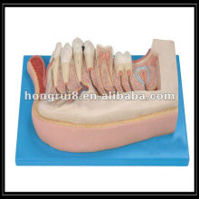 ISO Amplified Children Teeth Model, Lower Jaw of a 12-Year-Old Child HR/B10002